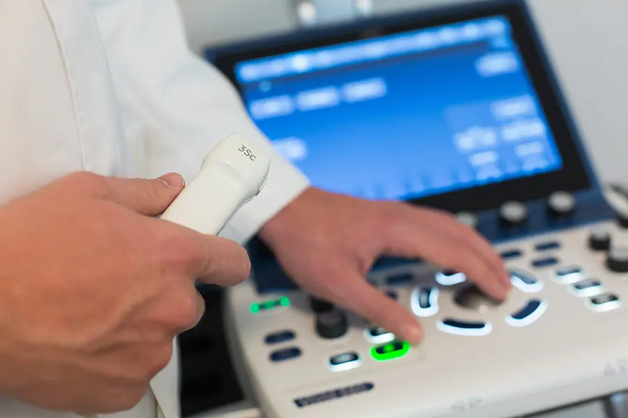 Color doppler renalnih arterija