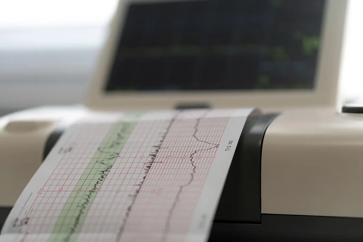 CTG monitoring