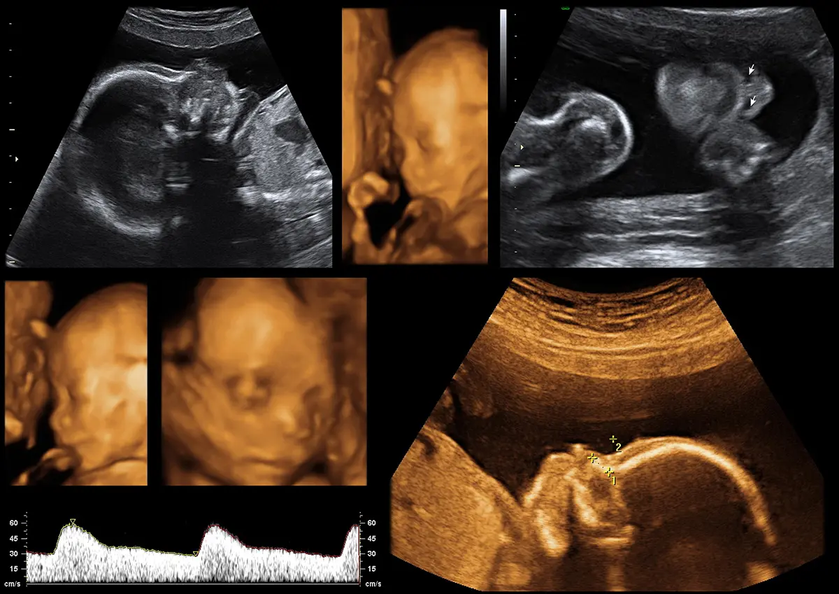 Mini Anomaly Scan